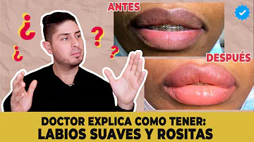 ¿Cómo puedo conseguir que mis labios oscuros vuelvan a ser rosados?