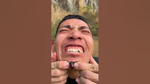 How I Cured a Bug Bite with Yogurt in theWild |Survival Hacks#funny #comedy #shorts #video