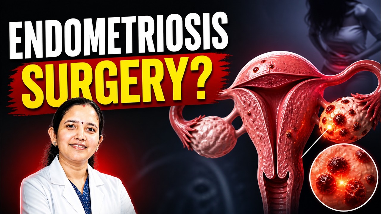 #1 Tip before Endometriosis Surgery...