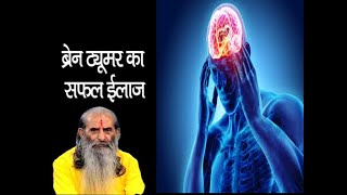 ब्रेन ट्यूमर (Brain tumor ) के लक्षण और आयुर्वेदिक उपचार || Brain Tumor Treatment || swasth vichar