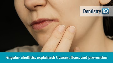 Angular cheilitis, explained: Causes, fixes, and prevention