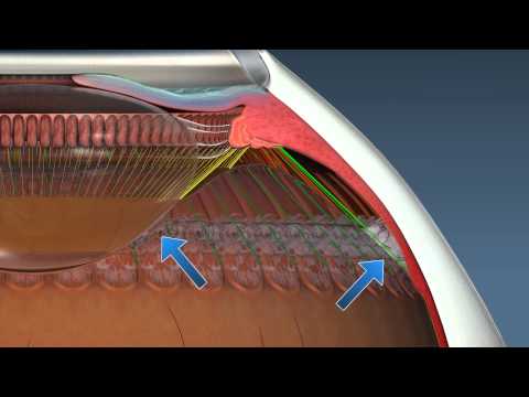 Video: Hvor er ora serrata retinae?