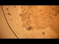 Как выглядит сало поросенка под микроскопом