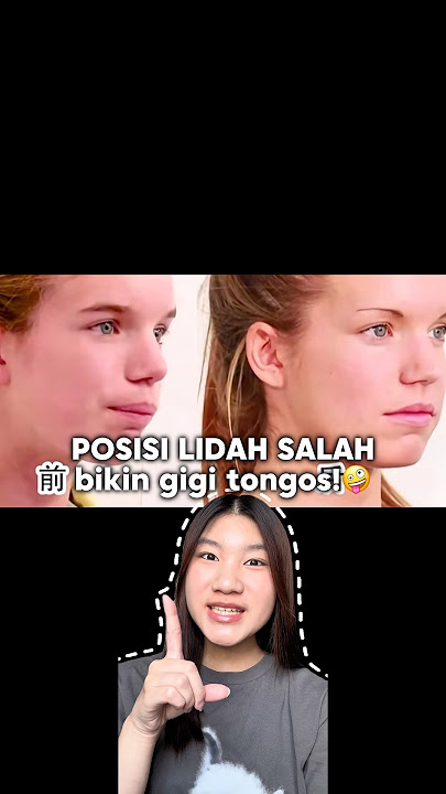 Posisi lidah yang salah menyebabkan gigi bengkok‼️🦷 #posisilidah #gigibengkok #douyin_china