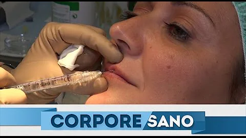 ¿Cómo puedo rellenar el labio superior de forma natural?