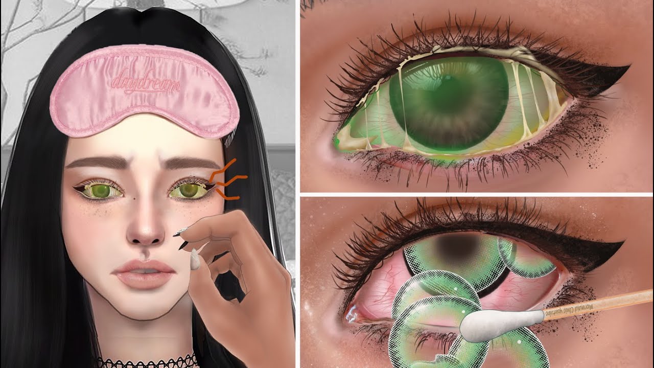 ASMR Why you shouldn’t sleep with contact lenses on contact lens