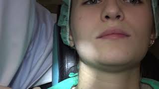 Oral Mucosa Examination.   Dr. Andrés Blanco USC