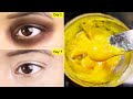 7 Night Challenge - I Removed DARK CIRCLES with Coffee Eye Serum | Remove Eye Wrinkles & Puffy Eye