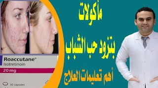 مأكولات ممنوعة لحب الشباب -  أهم تعليمات العلاج