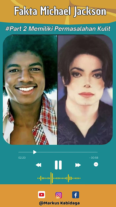 TAHUKAH KAMU? Michael Jackson didiagnosis menderita vitiligo dan lupus #shortvideo #trending #fypシ
