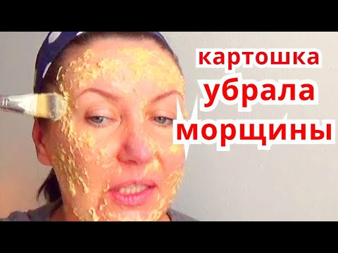 Видео: 15 лучших масок для лица из картофеля для сияющей, светлой и гладкой кожи