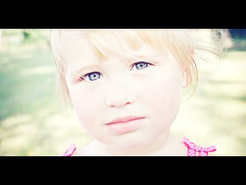 Vídeo: Albinismo - Causas, Tipos, Sinais, Tratamento, Complicações, Prevenção