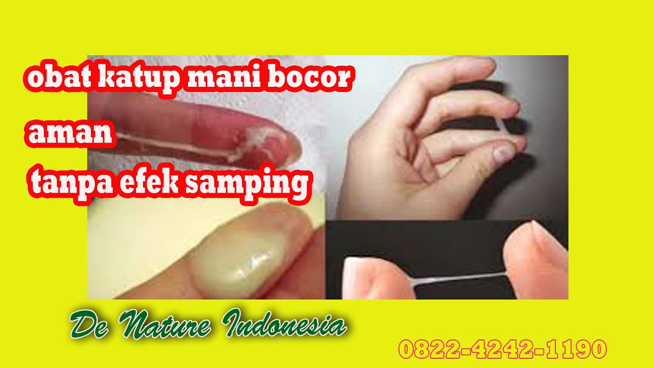 Penyebab Kutup air mani bocor Dan Cara Mengobatinya Obat ...