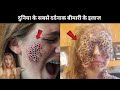 Most painful Medical treatments in history || By Awesome list hindi