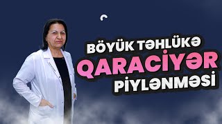 Qaraciyər Piylənməsi