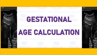 How to Measure Gestational Age with the Help of Multiple Ultrasound Parameters screenshot 5