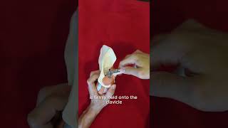 Distal Clavicle Fracture Explained in 60 Seconds!