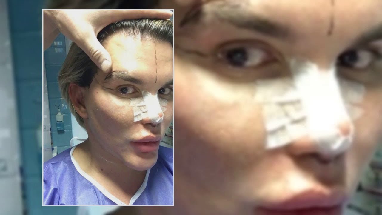 THE £400K FACE Human Ken Doll Rodrigo Alves reveals he’s going ahead ...