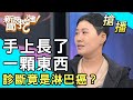 【搶播】手上長了一顆東西...診斷竟是淋巴癌？