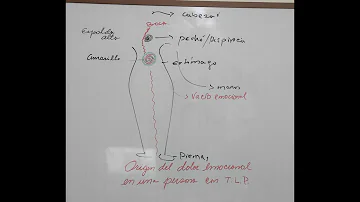 ¿Cómo describiría el dolor del TLP?