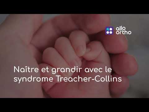Naître et grandir avec le syndrome de Treacher-Collins