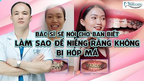 Niềng Răng Bị Hóp Má Vì Bạn Chưa Biết Điều Này | Nha Khoa Minh Châu