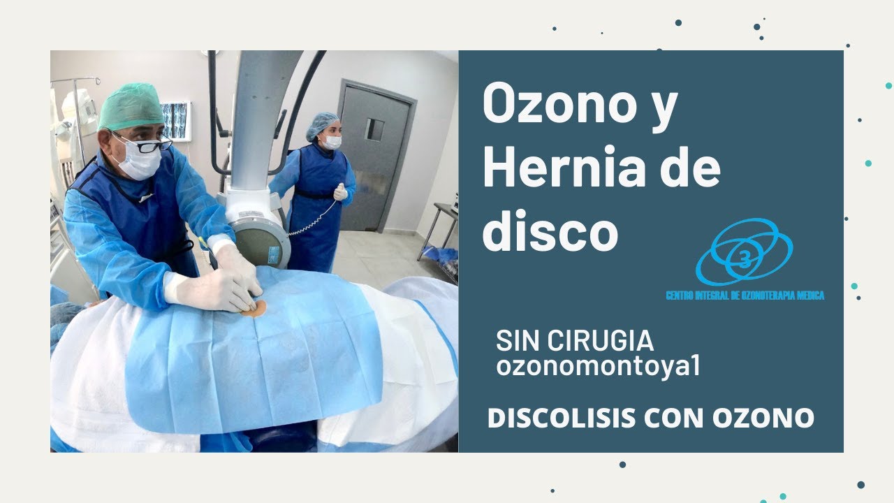Hernia de disco sin cirugia mexico primera division