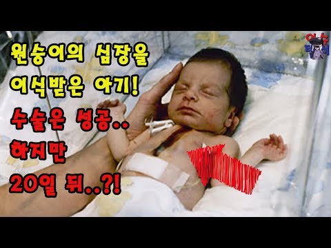 충격.. 동물의 심장을 이식받은 사람들!! &rsquo;이종장기이식&rsquo;의 현상황! _[이슈텔러]