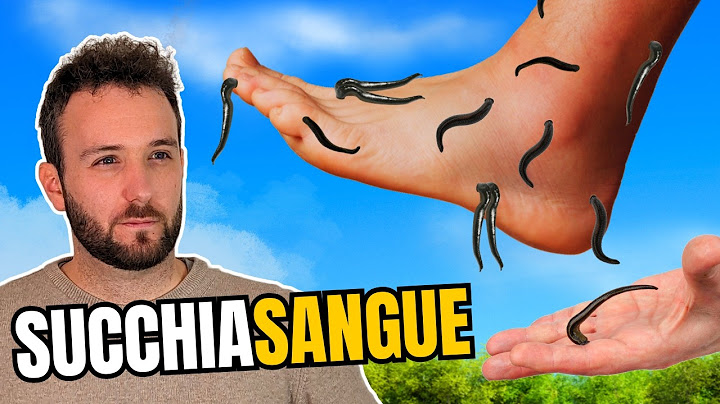 Non guarderai più le SANGUISUGHE ALLO STESSO MODO
