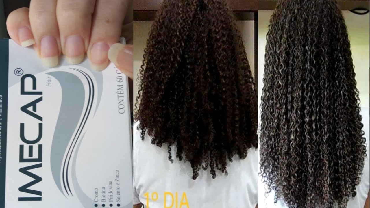 IMECAP HAIR RESULTADO + FOTOS - YouTube