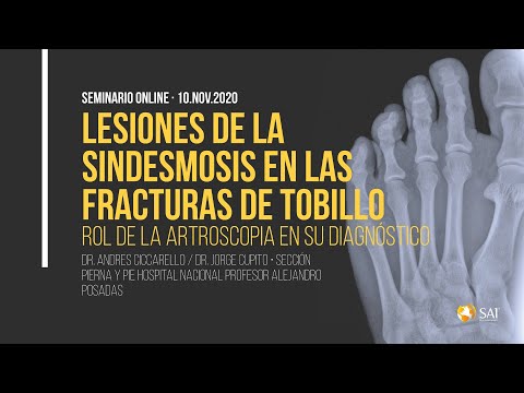 Lesión sindesmosis de Tobillo - Dr.Andres Ciccarello -Webinar Lesiones Traumáticas en Tobillo y Pie