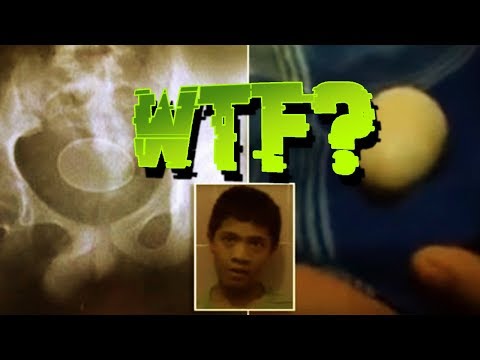 Vídeo: ¿Reptil O Charlatán? Adolescente Indonesia Pone Huevos. Los Médicos Se Sorprenden, Pero No Creen En - Vista Alternativa