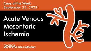 Case of the Week: Acute Venous Mesenteric Ischemia