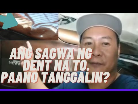 Video: Paano gumagana ang pagtanggal ng dent?