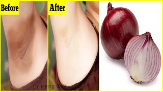 Whiten Dark Underarms Instantly Permanently with Red onion, carrot and honey | 100% Works At Home