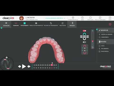 Tutorial ClearPilot 3.0