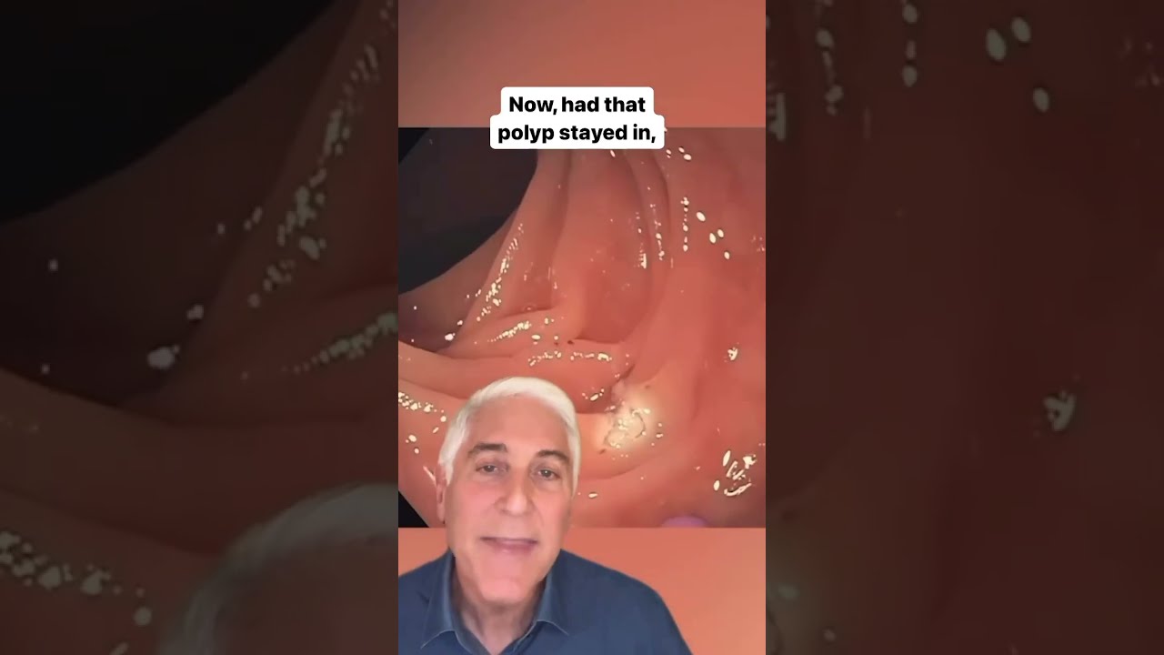 CBS News Dr Jon LaPook Demonstrates How Colonoscopies Can Save Your Life Shorts