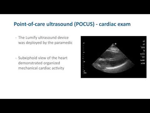 Image of Philips Lumify Reacts case study:  Pre-hospiatl cardiac ultrasound in an apparent PEA patient