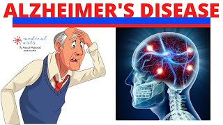 Alzheimer's Disease - Explained, Causes, Symptoms & Pathophysiology