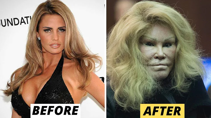 15 Celebrity Plastic Surgery Disasters - DayDayNews