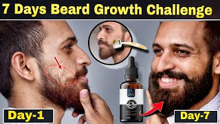 7 Days Beard Growth Challenge | How To Grow Beard Naturally | Beard Serum | Patchy (दाढ़ी)