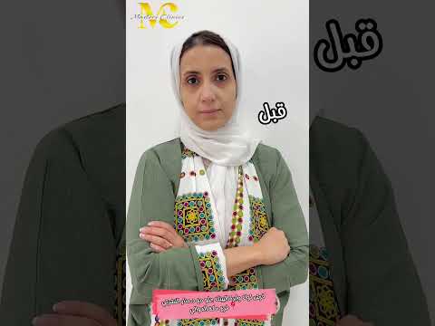 تجميل الوجه كامل السعودية تجميل عيادات تجميل بنات جمالك مصر بوتكس الوجه بلوجر فيلر