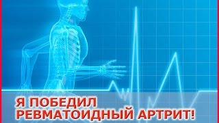 Личный опыт Как я вылечил РЕВМАТОИДНЫЙ АРТРИТ Личный опыт Как я вылечил РЕВМАТОИДНЫЙ АРТРИТ