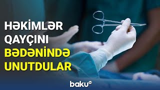 Həkimlər qayçını bədənində unutdular - BAKU TV