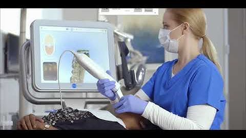 iTero Intraoral Scanner | Invisalign and Braces | Strongsville, OH