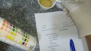 تحليل البول عملي(urine examination)وكتابة التقرير