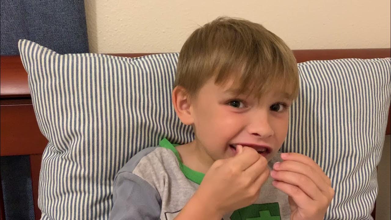 Expansion orthodontics; Reverse pull headgear / facemask YouTube