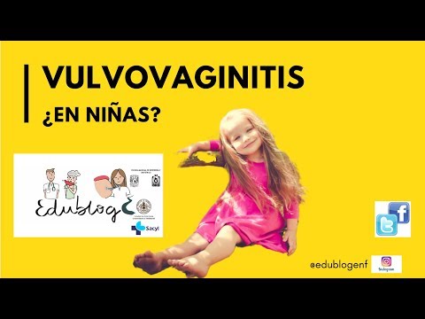 Video: Cómo Tratar La Vulvitis En Las Niñas