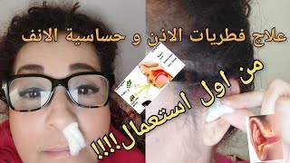 علاج حساسية الانفو القضاء على فطريات الاذن من اول استعمال جربوه ‍و دعاو معايا?