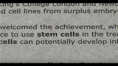 A Stem Cell Story